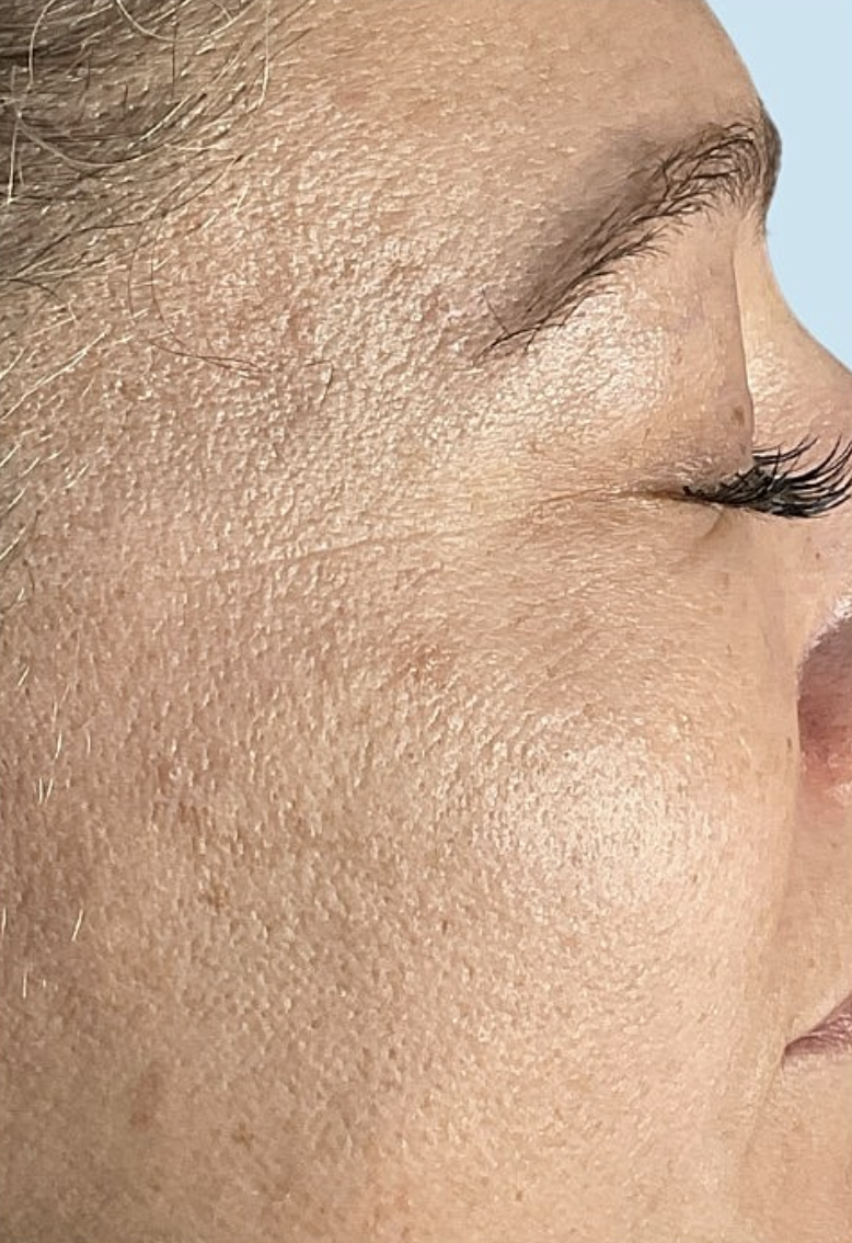Avant soin du visage