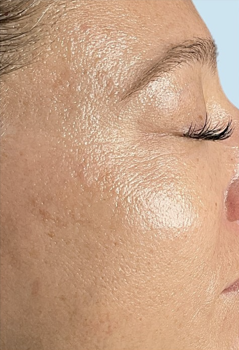 Après soin du visage — peau lissée et éclat retrouvé